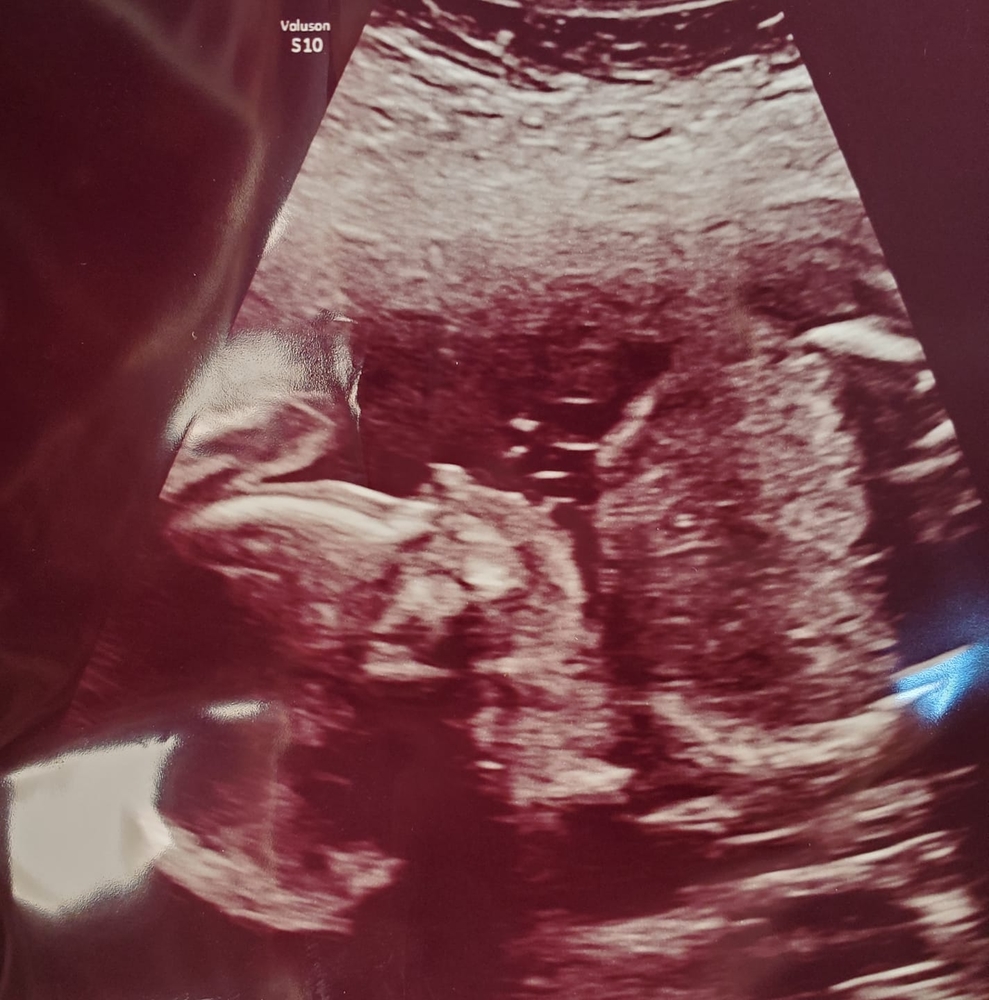 Meet your Posher, Maurie